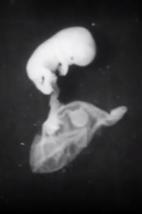 Early Human Fetal Activity Poster