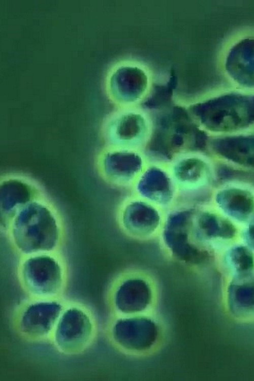 ERYTHROPOIEISIS AND ERYTHROPOIETIN Poster