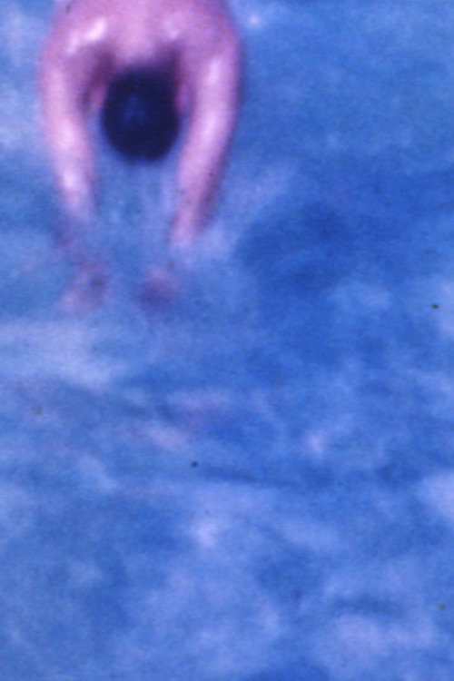 Healing Process Poster