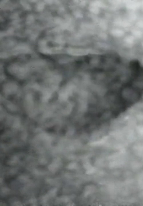 Mouth to Mouth Poster