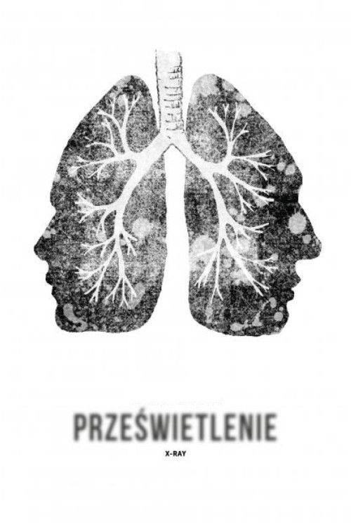 X-Ray Poster