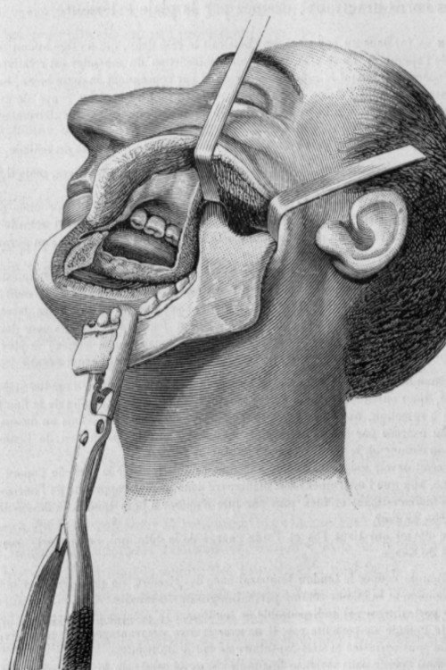 Apocalypse 1900 Poster