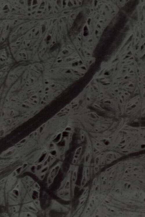 Ecosystem 6 ~ A Sort of Mycelium Poster