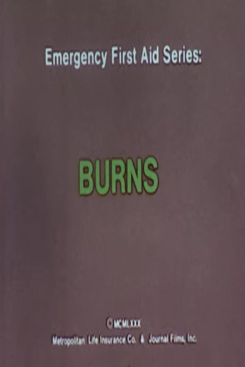 Emergency First Aid Series: Burns Poster