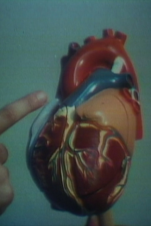 Open Heart Surgery Poster