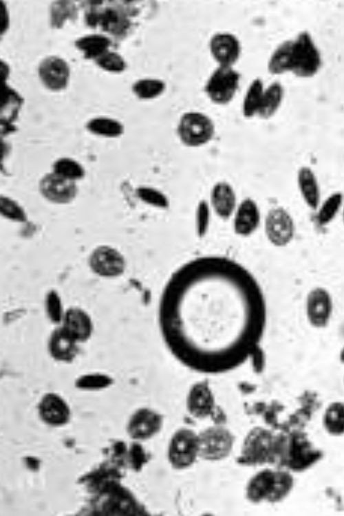 Anthony van Leeuwenhoek Poster