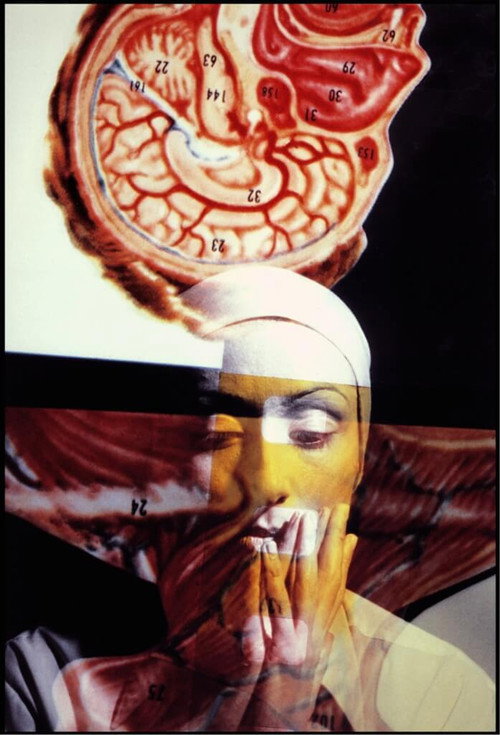 Arteria magna in dolore laterali Poster