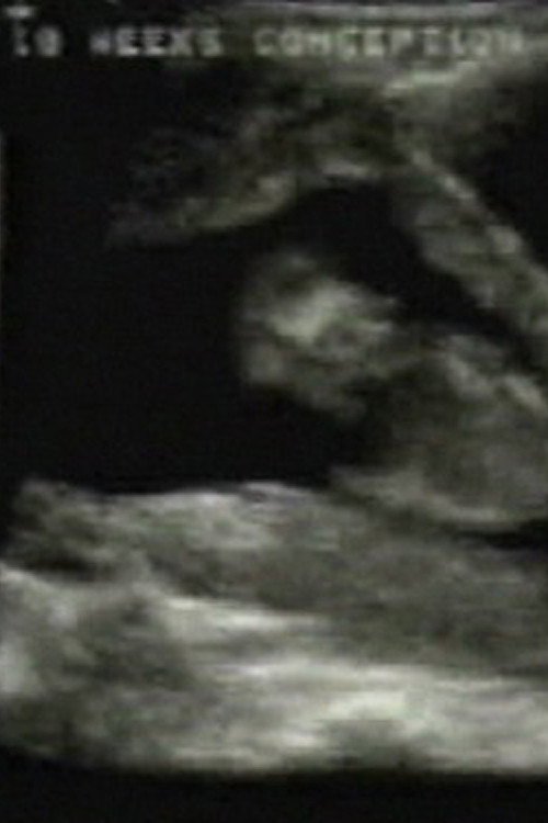 Remotely In Touch Poster