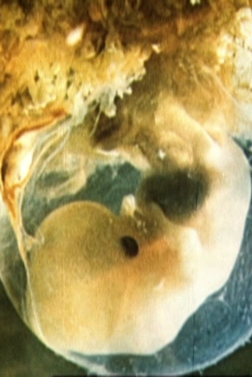 Schwangerschaft und Geburt Poster