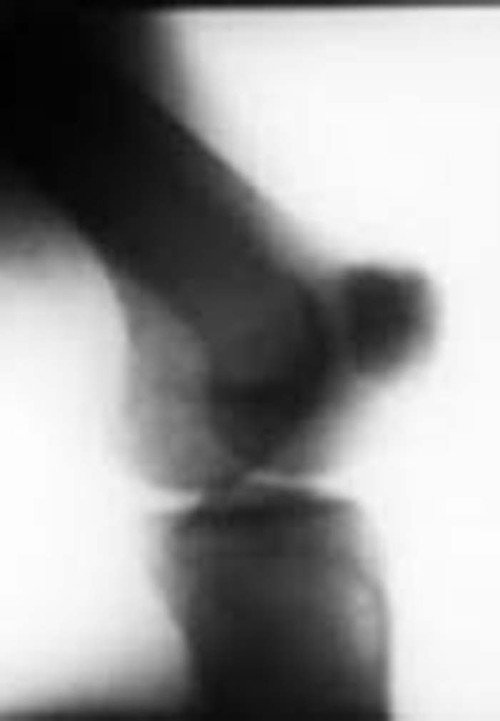 Roentgenfilm V Poster