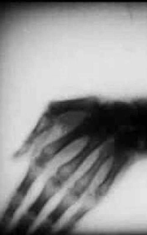 Roentgenfilm III and IV Poster