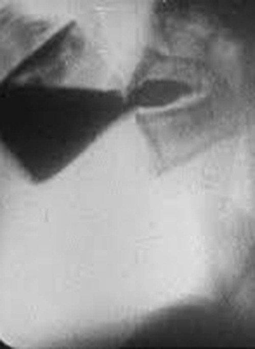 Roentgenfilm I Poster