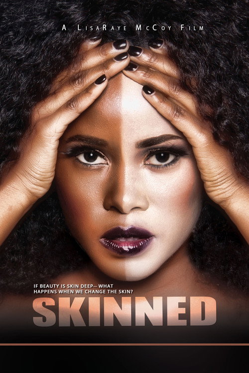 Skinned Poster