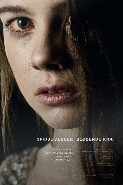 Spidse albuer, blødende knæ Poster
