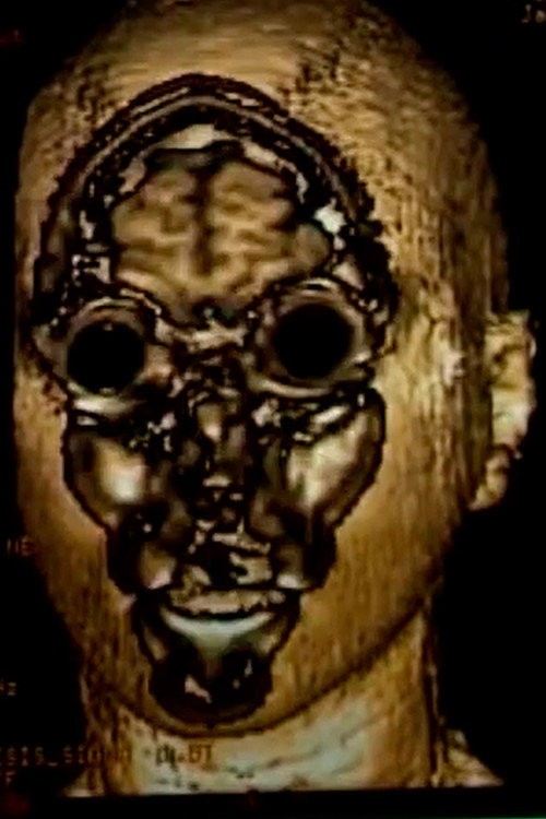 Ressonàncies magnètiques Poster