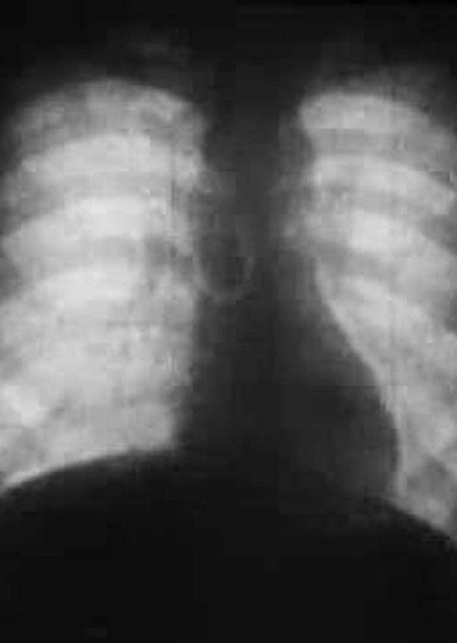 Roentgenfilm II Poster