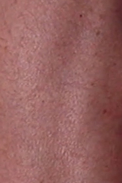 Suite: My Father's Leg Poster