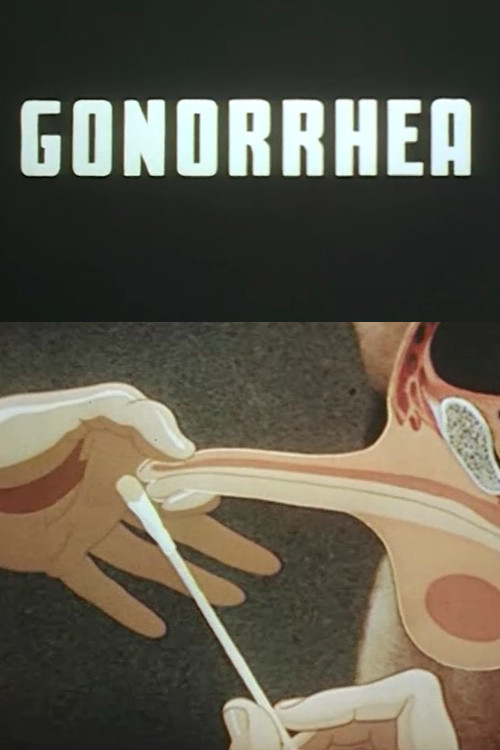 Gonorrhea Poster