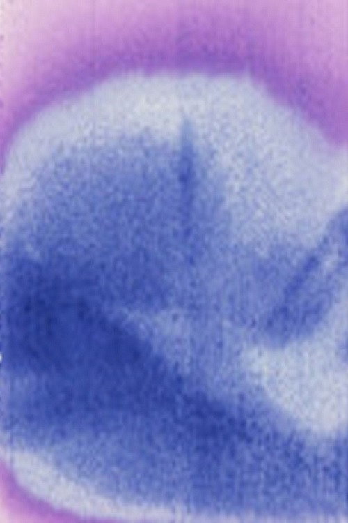 Acidfilmda Poster