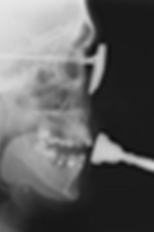 Studies in Diagnostic Cinefluorography Poster