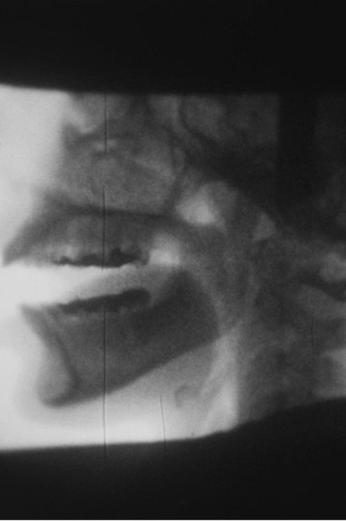 X-ray Poster